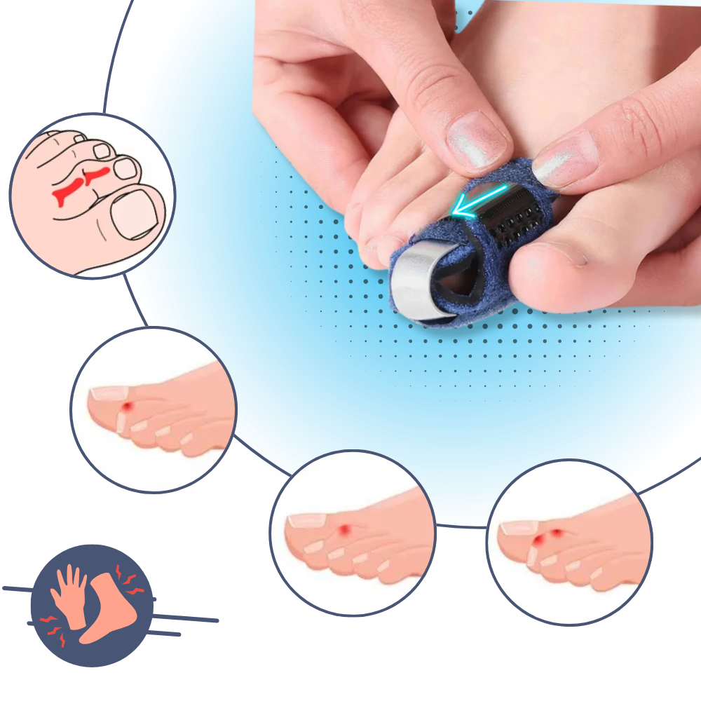 Raddrizzatore per dita dei piedi regolabile e discreto - Ozerty