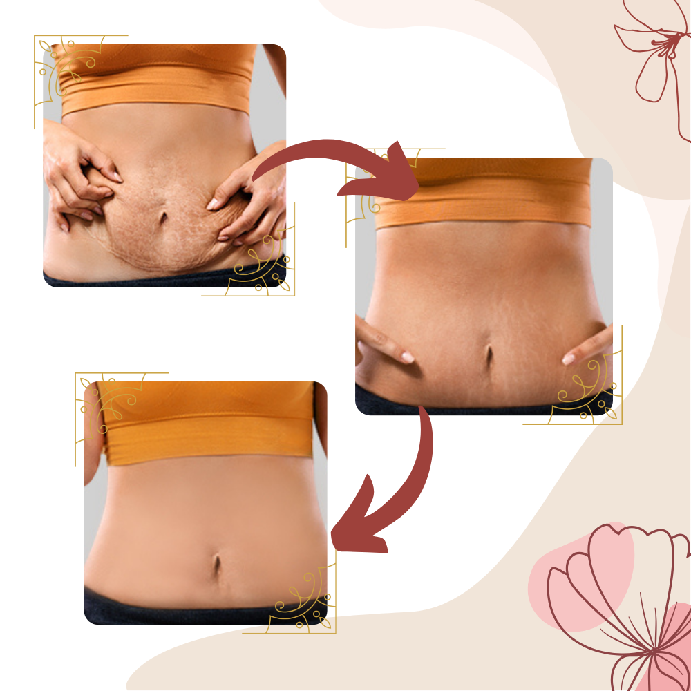 Massaggiatore per cellulite a vibrazione ad alta frequenza - Ozerty