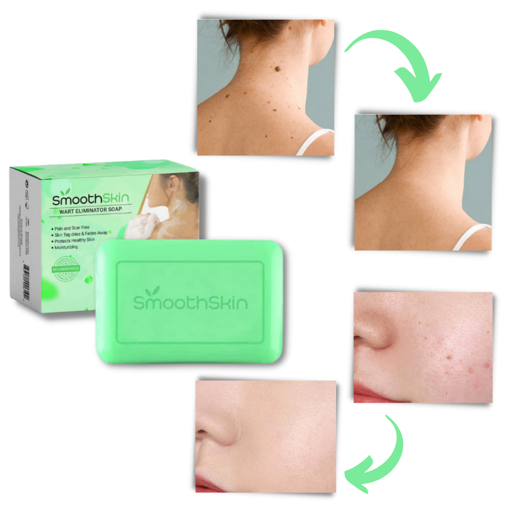 Esfoliante idratante Sapone per la rimozione delle verruche - Ozerty