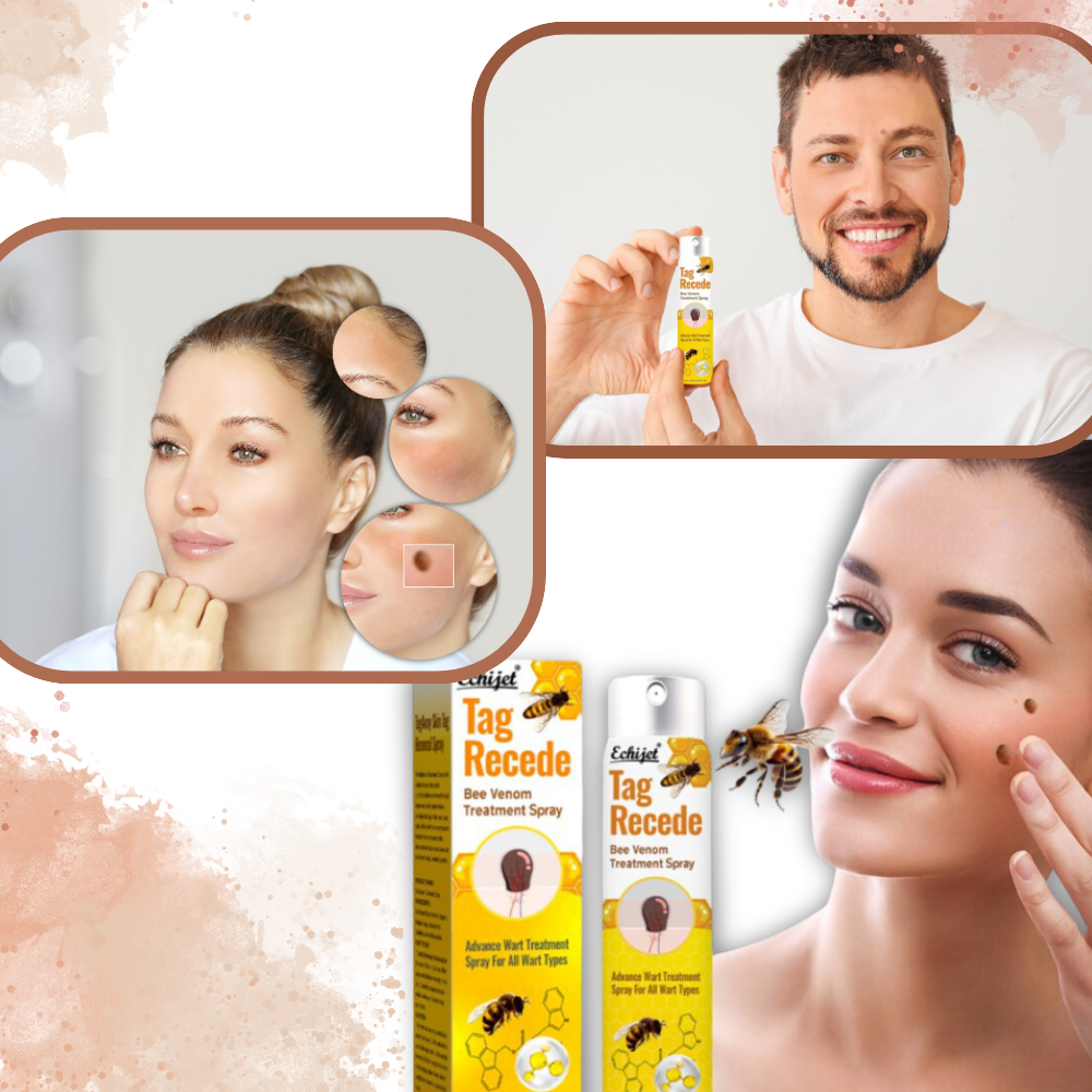 Rimuovi Escrescenze Cutanee Non-Invasivo - Ozerty