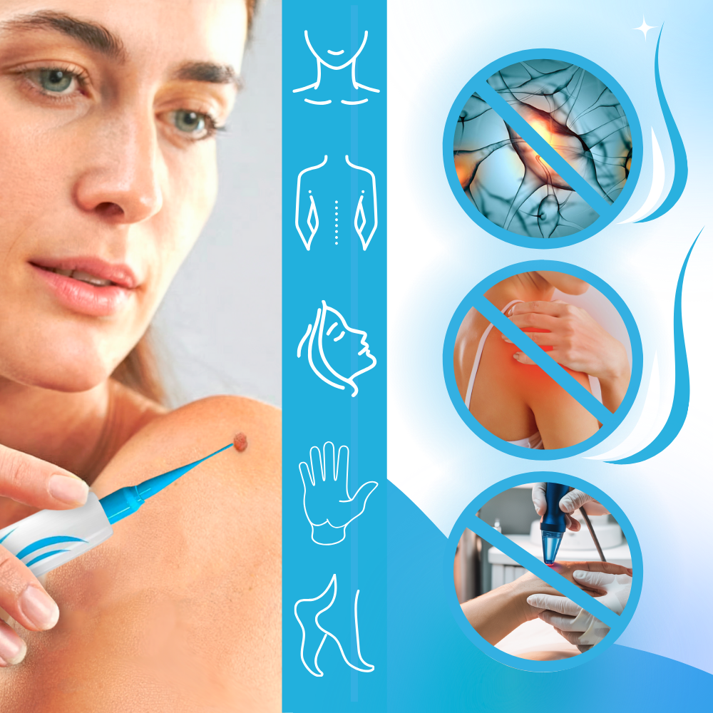 Tecnica di legatura per la rimozione - Ozerty