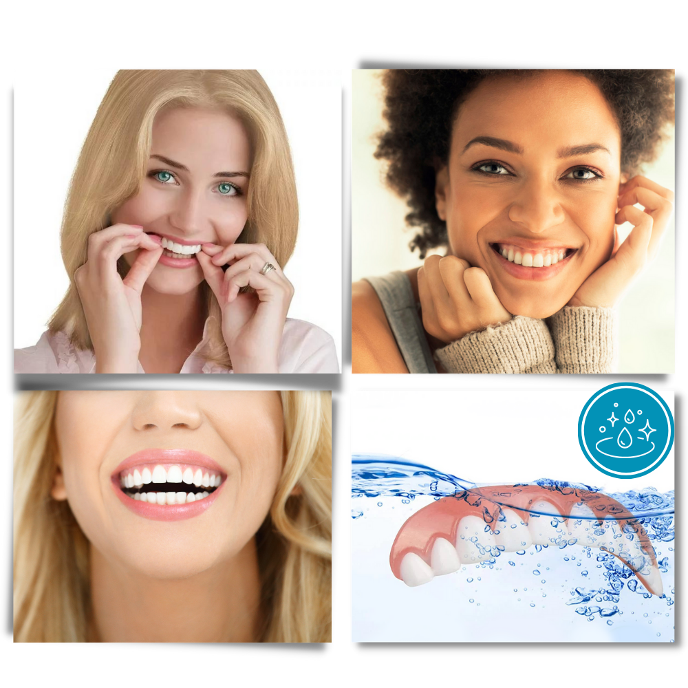 Faccette dentali a scatto - Ozerty