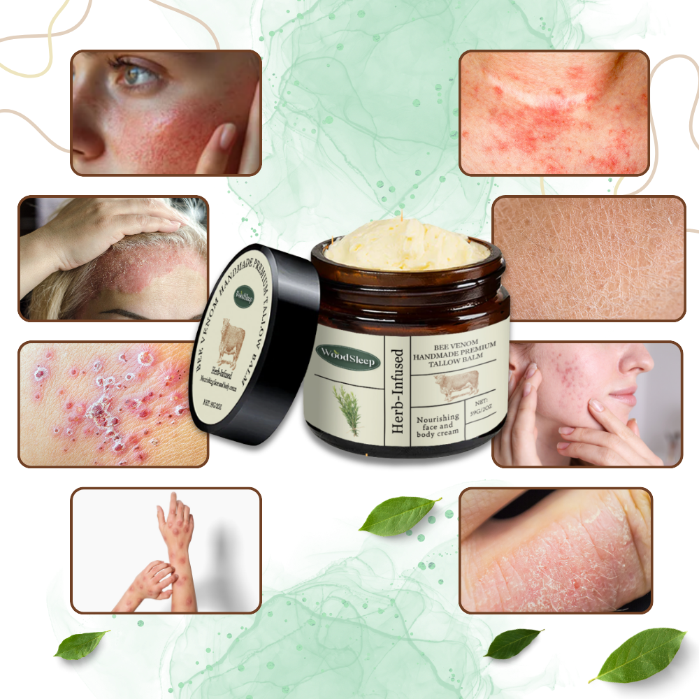 Crema Ultra Idratante al Veleno D'api - Ozerty