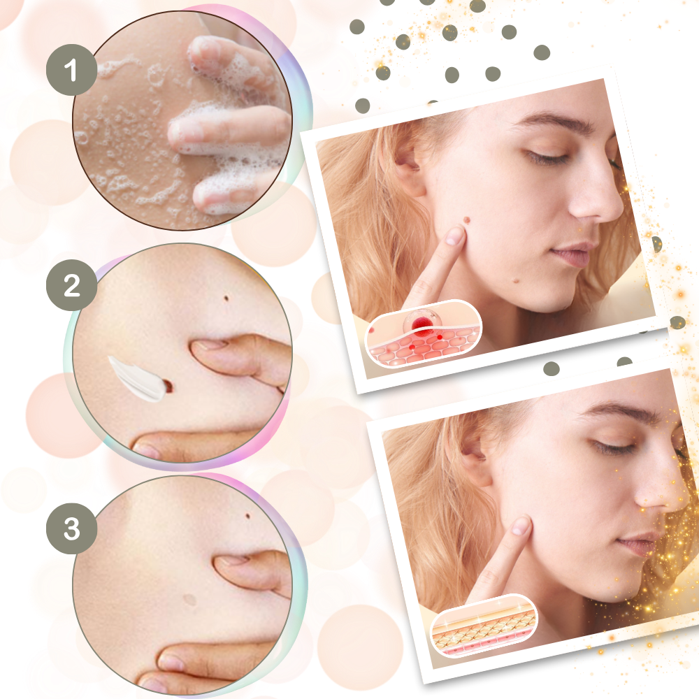 Crema Ultra Idratante al Veleno D'api - Ozerty