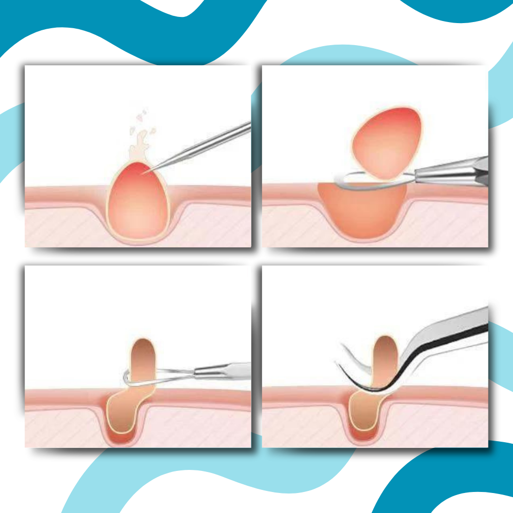 Pinzette a punta ultra precise - Ozerty