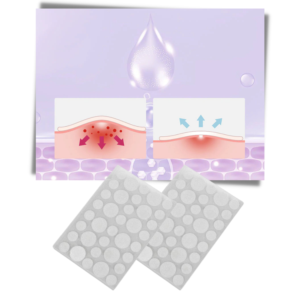 Confezione da 36 cerotti invisibili per l'acne - Ozerty