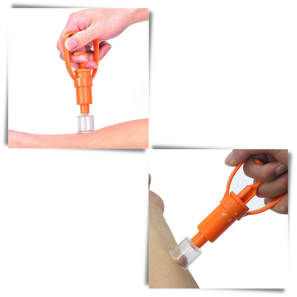 Kit di emergenza per l'estrazione del veleno