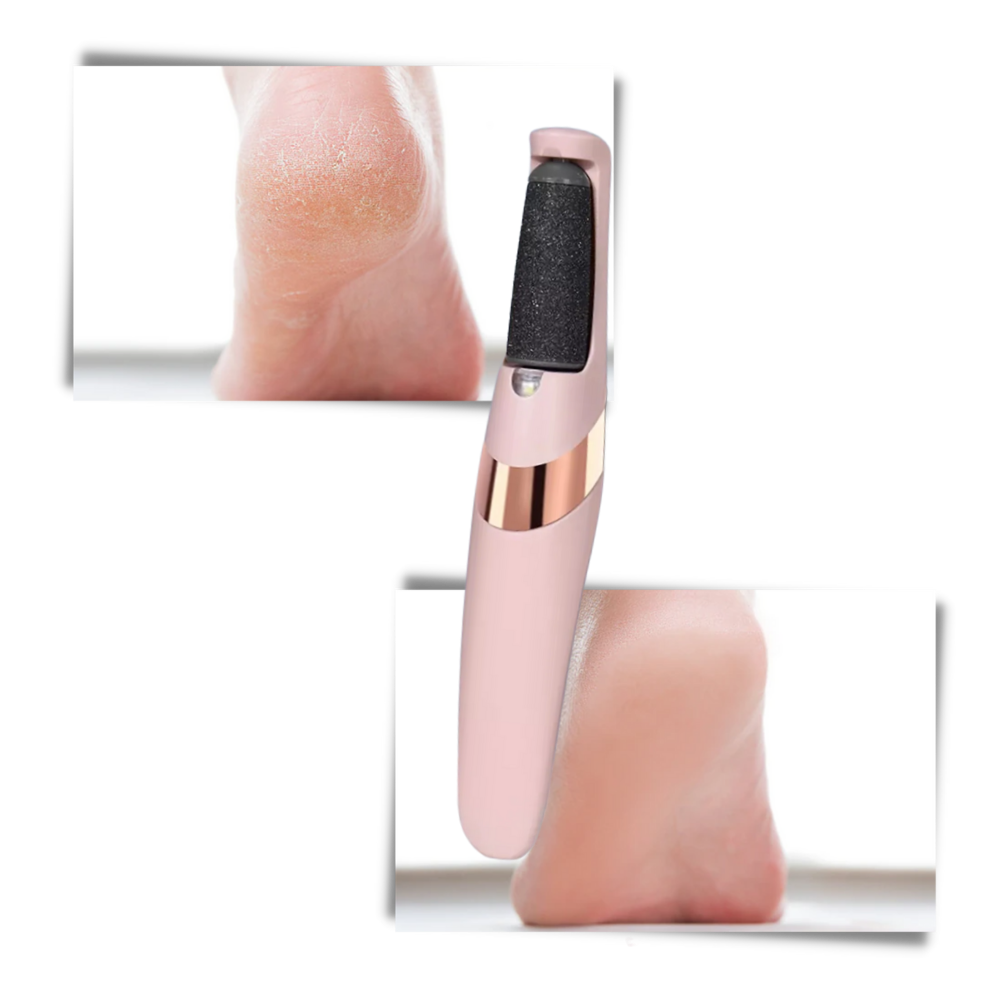 Rimuovi calli elettrico - Ozerty