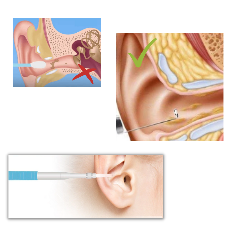 3 in 1 Telecamera auricolare - Ozerty