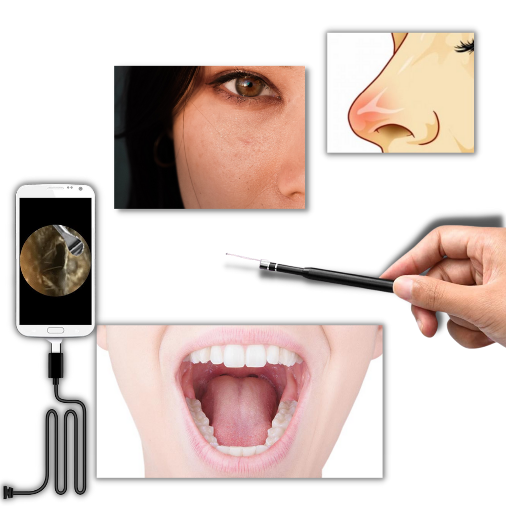 3 in 1 Telecamera auricolare - Ozerty