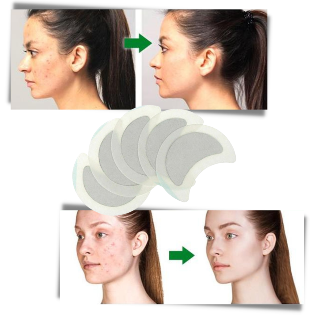 5 x Cerotti a base di erbe antisudore