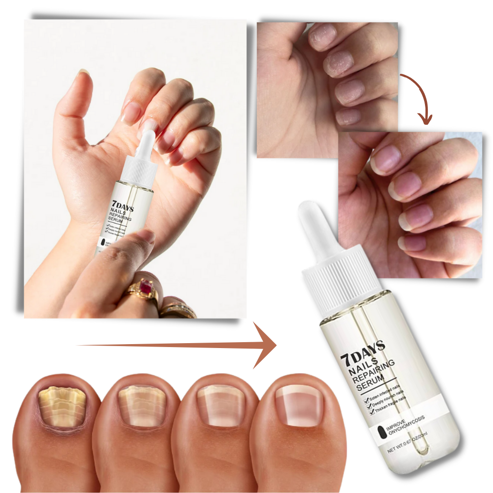 Essenza per la riparazione delle unghie 7 giorni - Ozerty