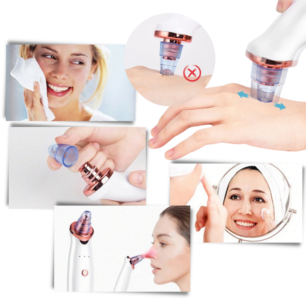 Aspiratore per punti neri - Ozerty