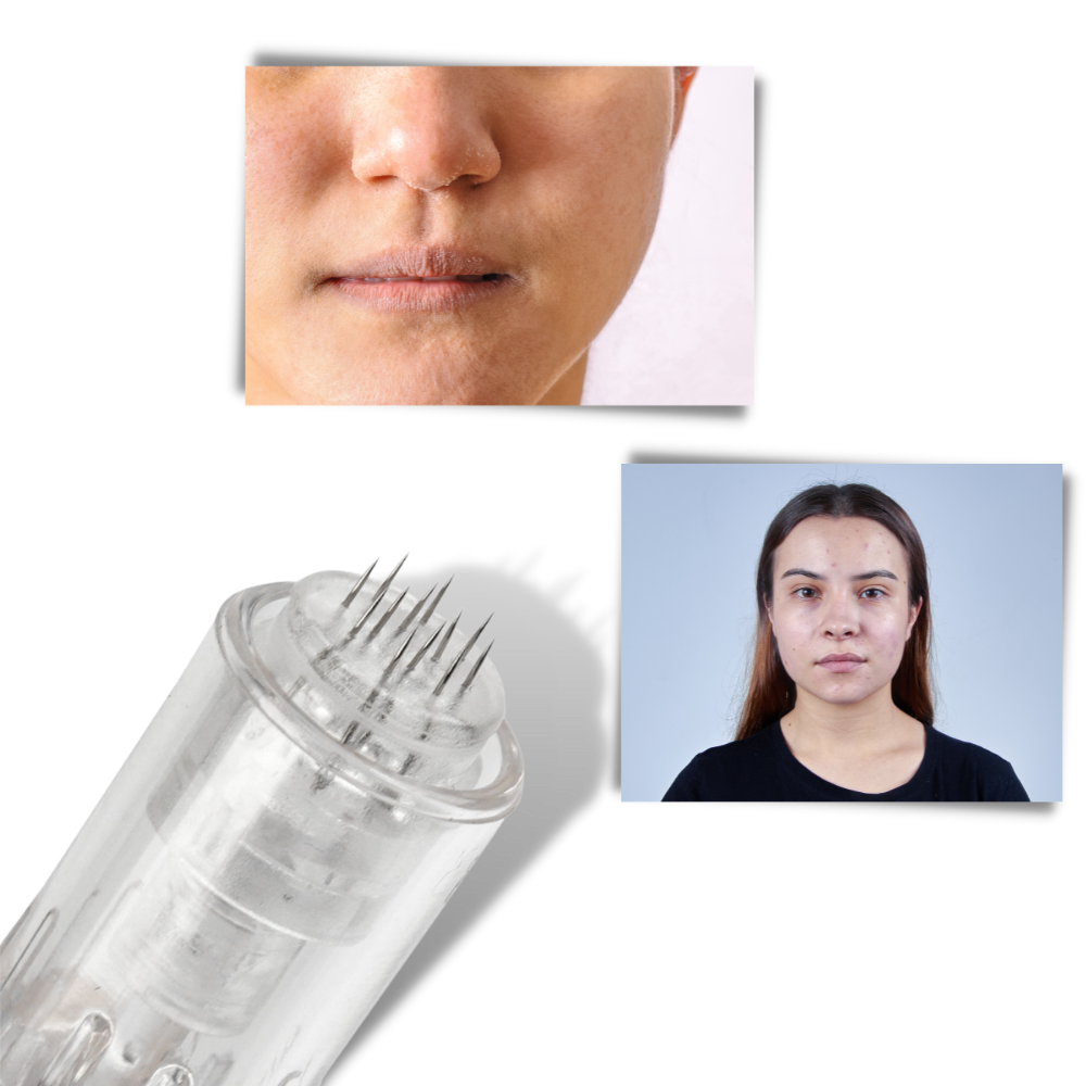 Penna per micro-needling dermico - Ozerty