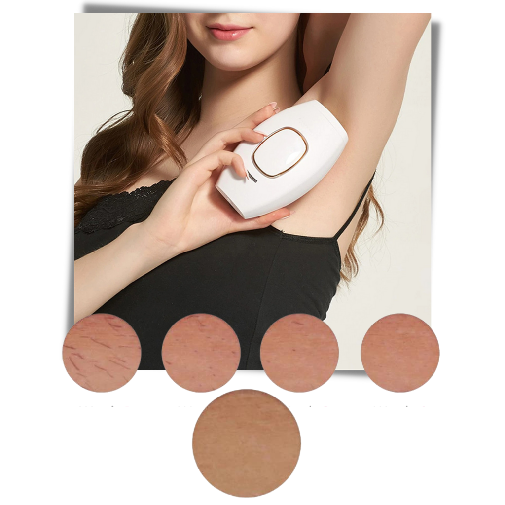 Mini laser IPL per la rimozione dei peli - Ozerty