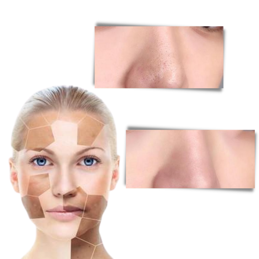 Maschera di tè verde pulizia profonda per rimuovere i pori e i comedoni