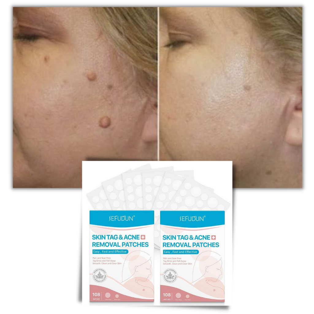 Cerotto per il trattamento di rimozione delle escrescenze della pelle - Ozerty