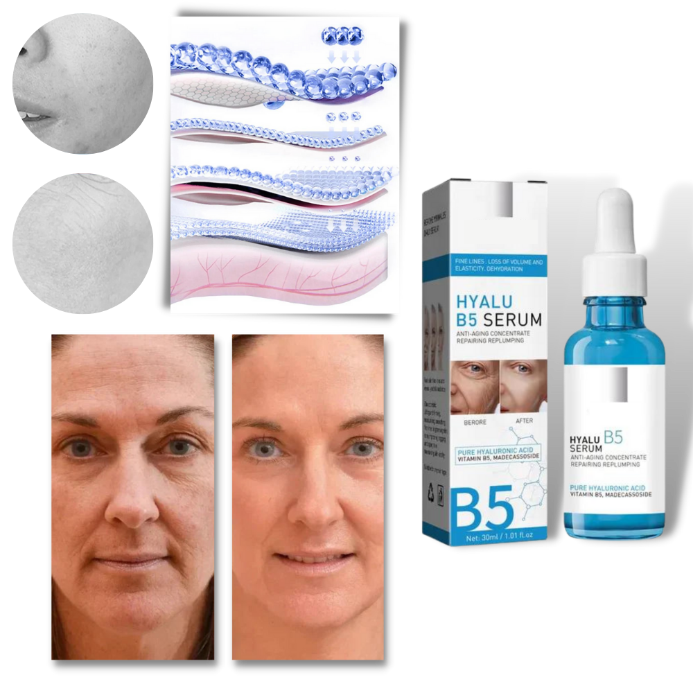 Siero ringiovanente all'acido ialuronico Hyalu B5 - Ozerty