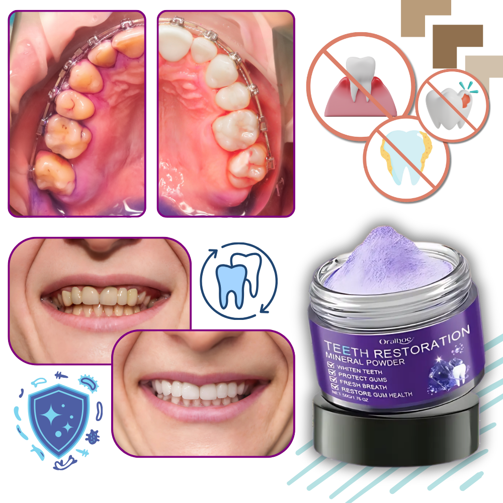 Sbiancante Dentale Fresh Boost - Ozerty