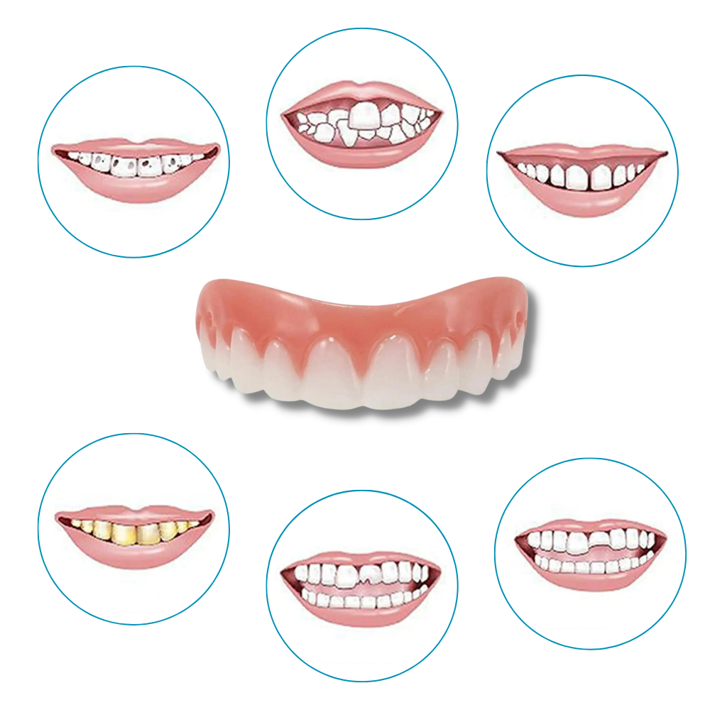 Faccette dentali a scatto - Ozerty