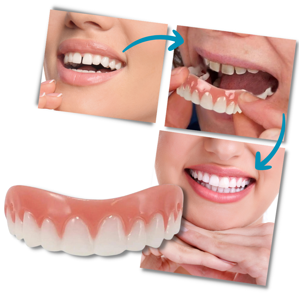 Faccette dentali a scatto - Ozerty