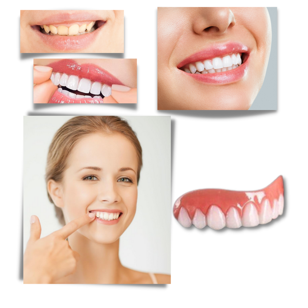 Faccette dentali a scatto - Ozerty