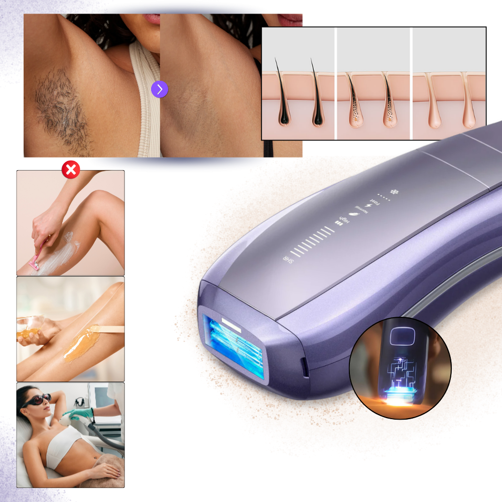 Dispositivo di Depilazione SkinSync - Ozerty