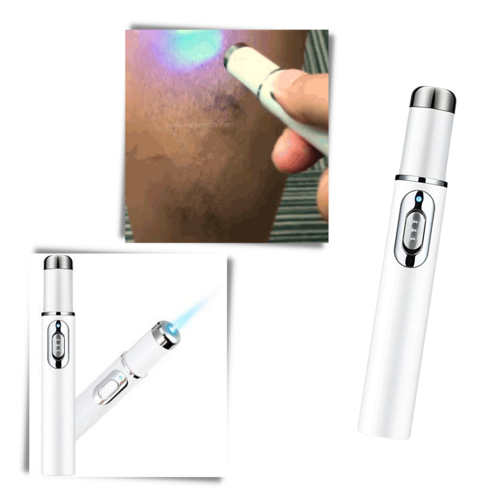 Penna per la terapia della pelle a luce blu - Ozerty