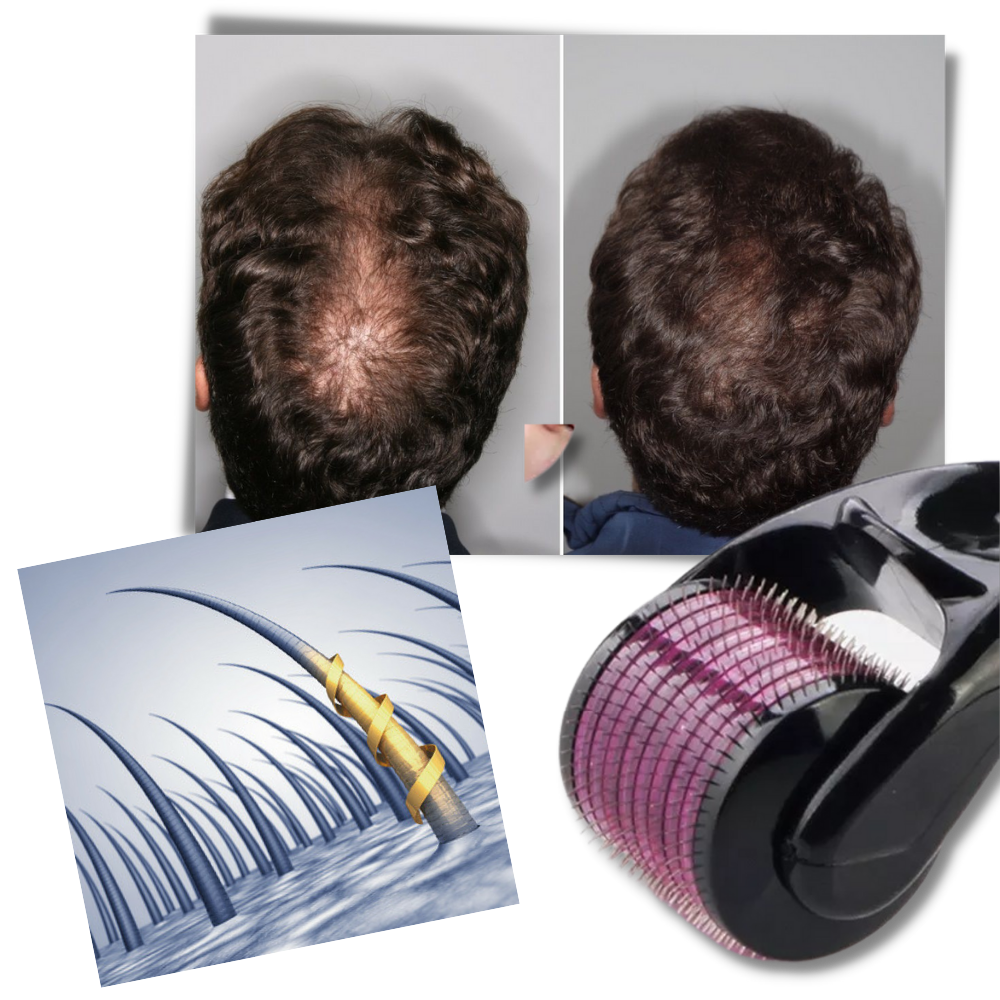 Rullo Derma per la crescita di capelli e barba - Ozerty
