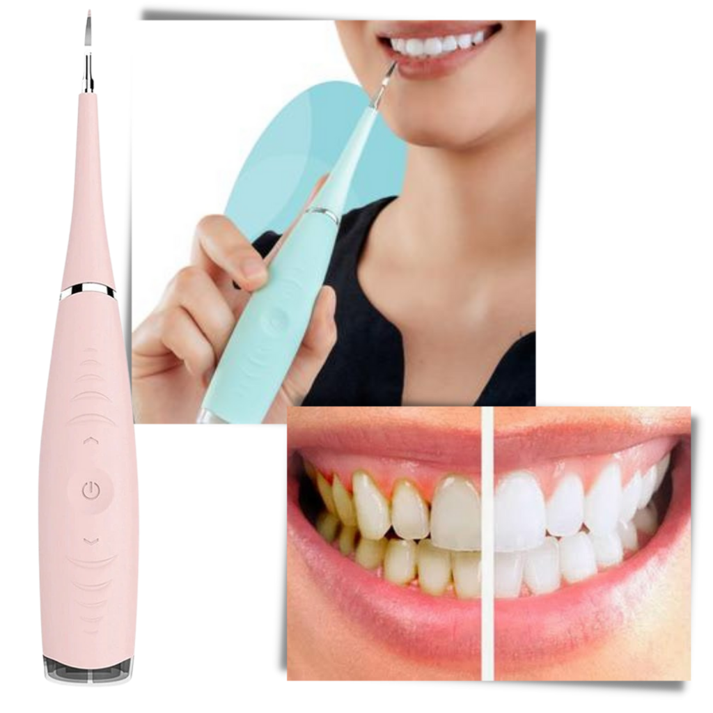 Macchina per la pulizia profonda del tartaro dei denti - Ozerty