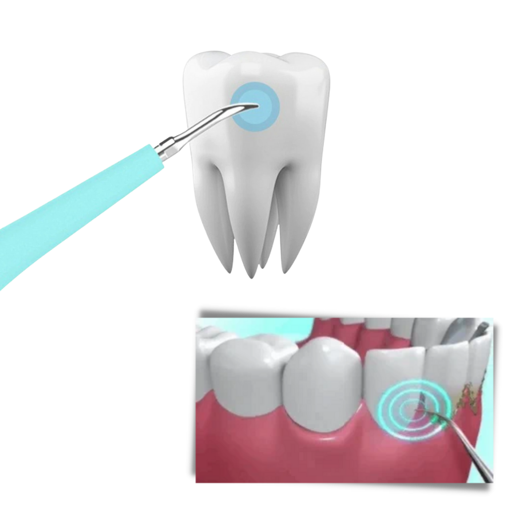 Macchina per la pulizia profonda del tartaro dei denti - Ozerty
