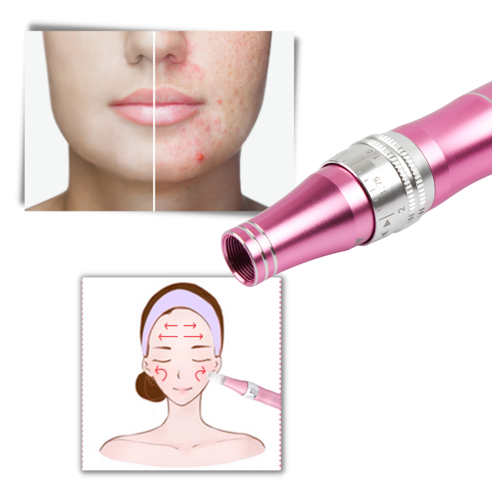 Penna per micro-needling dermico - Ozerty