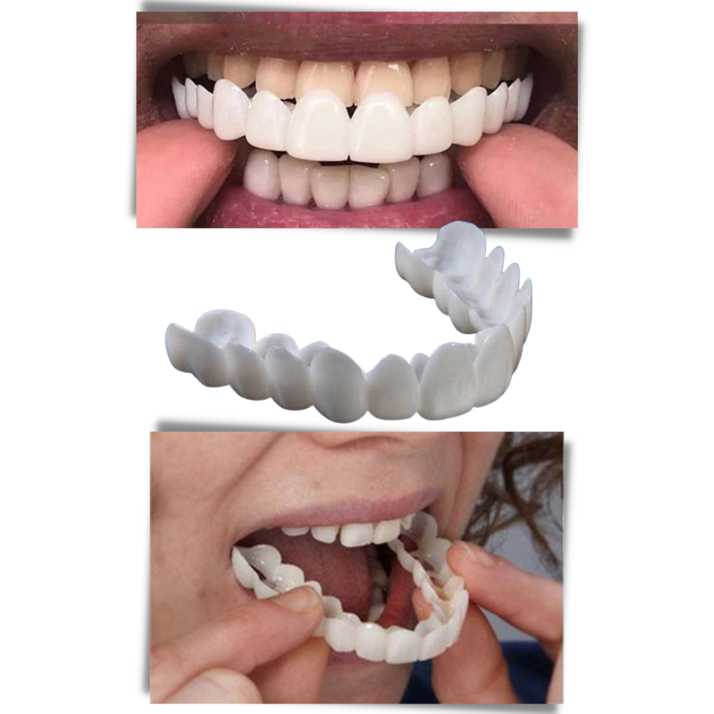 Copertura dentale del sorriso perfetto - faccette confortevoli - Ozerty